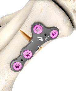 Bone plate non locking